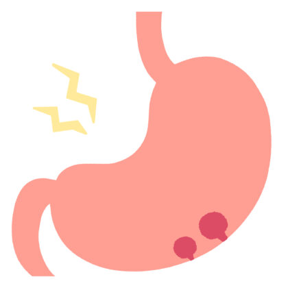 胃ポリープとは