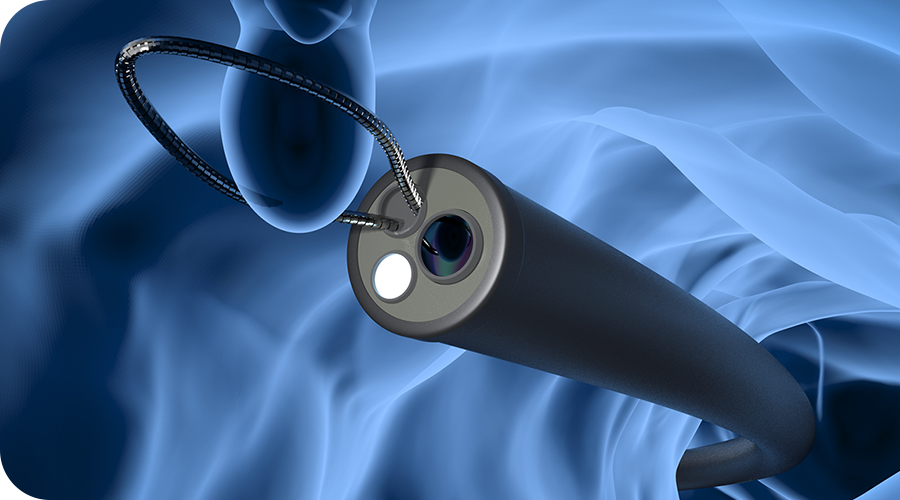 大腸ポリープ切除で大腸がんの予防